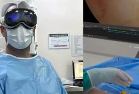 Apple Vision Pro, doktora ameliyatta yardımcı oluyor